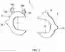 Fig. 02 - Clearance adjusting member