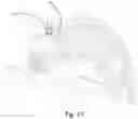 Fig. 16 - GEARBOX