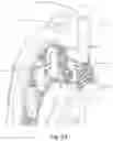 Fig. 18 - GEARBOX
