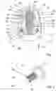 Fig. 02 - CHECK VALVE DAMPING