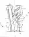 Fig. 01 - Fuel systems for torch ignition devices