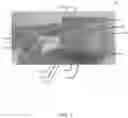 Fig. 09 - Fixtureless lensmeter system