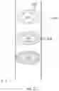 Fig. 12 - METHOD FOR MEASUREMENT OF TOTAL PROTEIN CONTENT AND DETECTION OF PROTEIN VIA IMMUNOASSAY IN A MICROFLUIDIC DEVICE