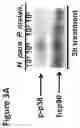 Fig. 10 - Methods to identify and treat subjects having corticosteroid-resistant inflammatory diseases