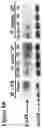 Fig. 20 - Methods to identify and treat subjects having corticosteroid-resistant inflammatory diseases