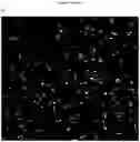 Fig. 04 - CATSPER-ACTIVITY-TEST FOR DETERMINING MALE INFERTILITY