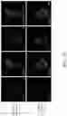 Fig. 27 - TROPHOBLAST STEM CELL, METHODS OF PREPARATION AND USES THEREOF