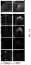 Fig. 28 - TROPHOBLAST STEM CELL, METHODS OF PREPARATION AND USES THEREOF