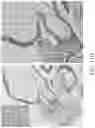 Fig. 57 - TROPHOBLAST STEM CELL, METHODS OF PREPARATION AND USES THEREOF