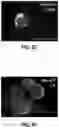 Fig. 10 - COMPOSITIONS AND METHODS FOR DIAGNOSING ACUTE INFECTIOUS PERITONITIS