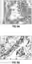Fig. 11 - COMPOSITIONS AND METHODS FOR DIAGNOSING ACUTE INFECTIOUS PERITONITIS