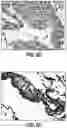 Fig. 12 - COMPOSITIONS AND METHODS FOR DIAGNOSING ACUTE INFECTIOUS PERITONITIS