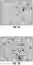 Fig. 13 - COMPOSITIONS AND METHODS FOR DIAGNOSING ACUTE INFECTIOUS PERITONITIS