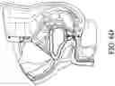Fig. 10 - Systems and methods for volumetric acquisition in a single-sided MRI scanner