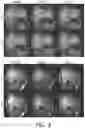 Fig. 05 - Parallel MR imaging using wave-encoding