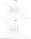 Fig. 06 - Optical Imaging Lens Assembly