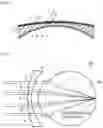 Fig. 06 - OPHTHALMOLOGICAL LENS