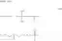 Fig. 90 - RESIST UNDERLAYER FILM-FORMING COMPOSITION