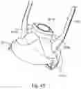 Fig. 46 - Toner container having a base portion with a discharge opening and a hole