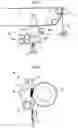 Fig. 03 - Heater and heating apparatus