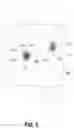 Fig. 04 - Alignment of medical images in augmented reality displays