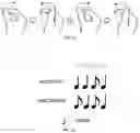 Fig. 07 - Wearable device enabling multi-finger gestures