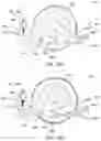 Fig. 16 - Input device