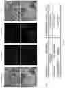 Fig. 09 - Computer vision systems and methods for detecting and aligning land property boundaries on aerial imagery