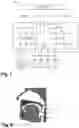 Fig. 02 - SYSTEM FOR ACOUSTIC IDENTIFICATION OF OBSTRUCTION TYPES IN SLEEP APNOEA, AND CORRESPONDING METHOD