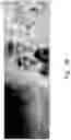 Fig. 06 - Automatic occlusion detection