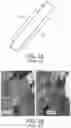 Fig. 02 - Dynamic interventional three-dimensional model deformation