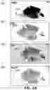 Fig. 03 - CANCER RISK STRATIFICATION BASED ON HISTOPATHOLOGICAL TISSUE SLIDE ANALYSIS