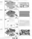 Fig. 04 - CANCER RISK STRATIFICATION BASED ON HISTOPATHOLOGICAL TISSUE SLIDE ANALYSIS