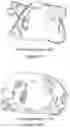 Fig. 33 - Flattened view for intra-lumenal navigation