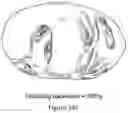 Fig. 34 - Flattened view for intra-lumenal navigation