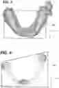 Fig. 03 - Dental image registration device and method
