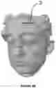 Fig. 04 - Method for registering virtual models of the dental arches of an individual with a digital model of the face of said individual