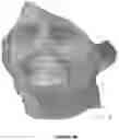 Fig. 07 - Method for registering virtual models of the dental arches of an individual with a digital model of the face of said individual