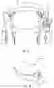 Fig. 04 - System including grip assembly and hip sensing assembly for rollator configured to provide feedback to user