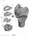 Fig. 05 - Human laryngeal model for simulation of endoscopic guided injection laryngoplasty surgery and human head and neck model