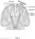 Fig. 03 - Systems and Methods for a Simulator for Brain Mapping