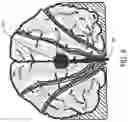 Fig. 10 - Systems and Methods for a Simulator for Brain Mapping