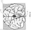 Fig. 11 - Systems and Methods for a Simulator for Brain Mapping