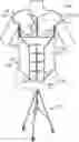 Fig. 01 - TEACHING MODEL FOR BREAST AND ABDOMINAL PROCEDURES