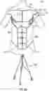 Fig. 03 - TEACHING MODEL FOR BREAST AND ABDOMINAL PROCEDURES