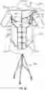 Fig. 07 - TEACHING MODEL FOR BREAST AND ABDOMINAL PROCEDURES