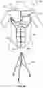 Fig. 11 - TEACHING MODEL FOR BREAST AND ABDOMINAL PROCEDURES