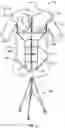 Fig. 15 - TEACHING MODEL FOR BREAST AND ABDOMINAL PROCEDURES