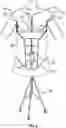 Fig. 16 - TEACHING MODEL FOR BREAST AND ABDOMINAL PROCEDURES