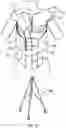 Fig. 19 - TEACHING MODEL FOR BREAST AND ABDOMINAL PROCEDURES